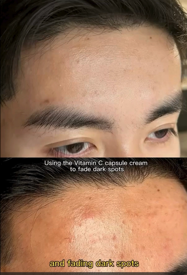 Glowing skin