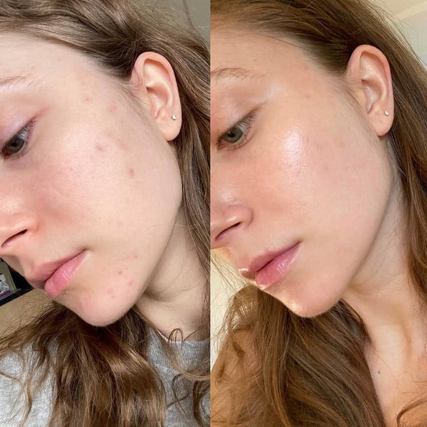 Chloe's review photo
